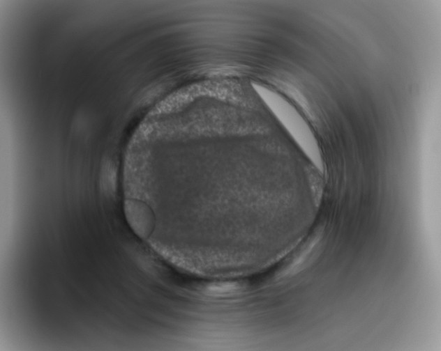 X0000095920357200802081118