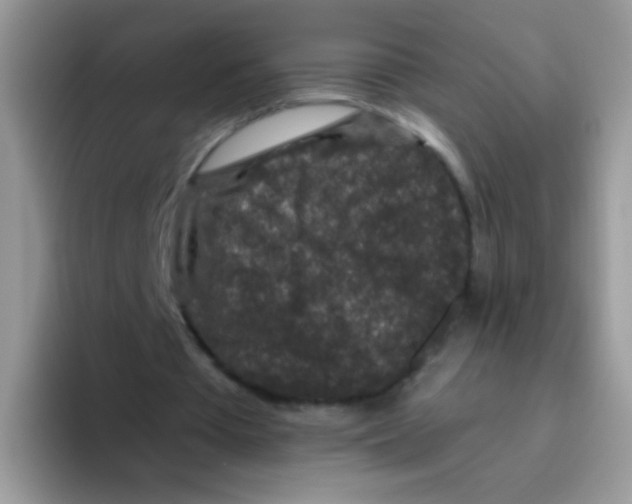 X0000095920385200802081117