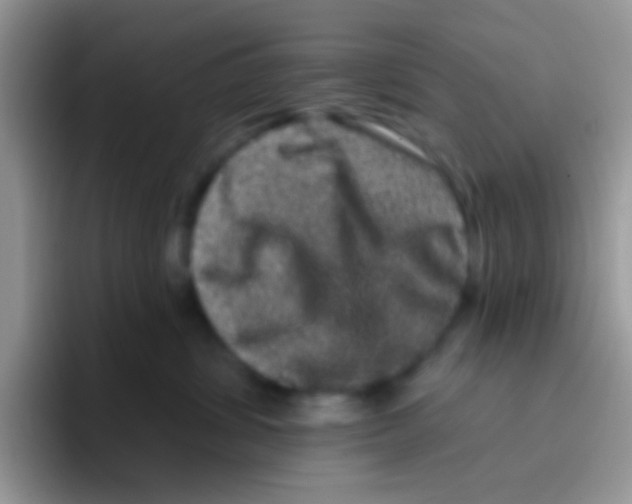 X0000095920428200802081117