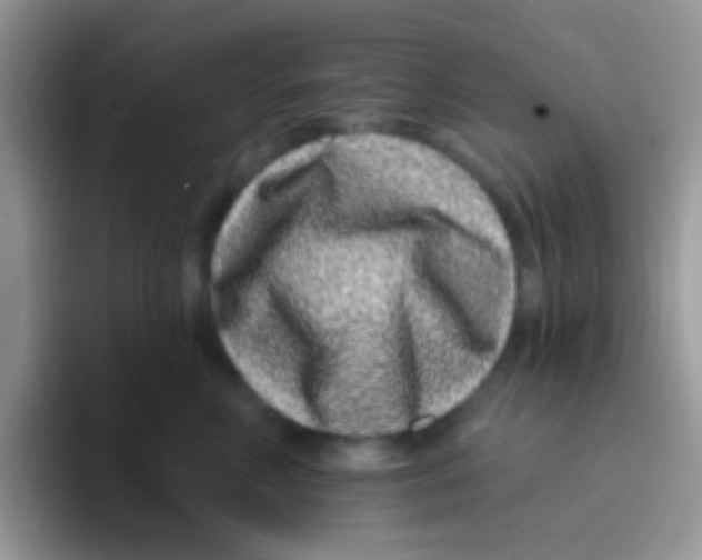 X0000095920618200802081114