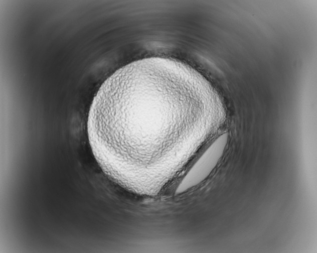 X0000095920917200802081110