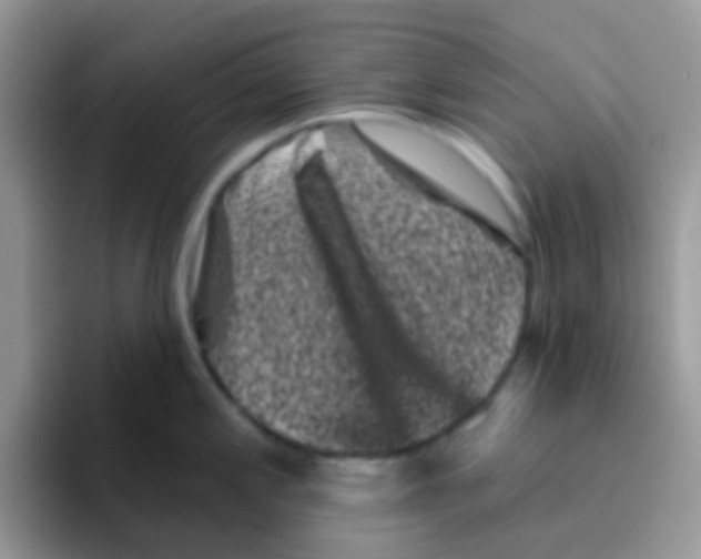 X0000095921197200802081107