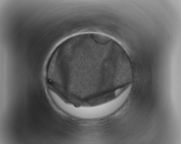 X0000095921519200802081103