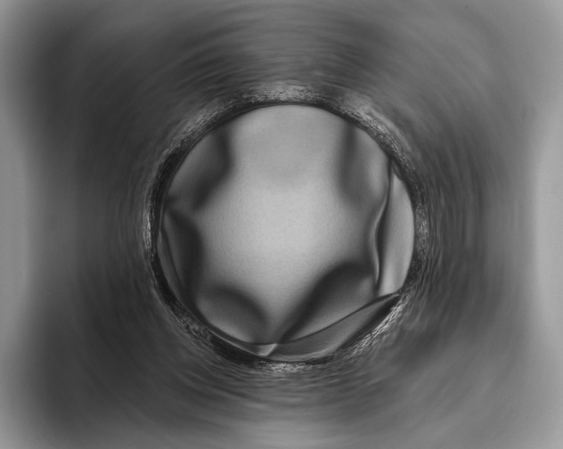 X0000095930158200802011028