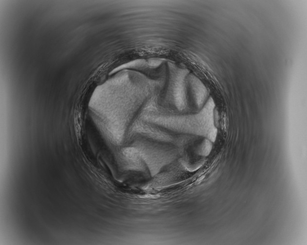 X0000095930915200802011018
