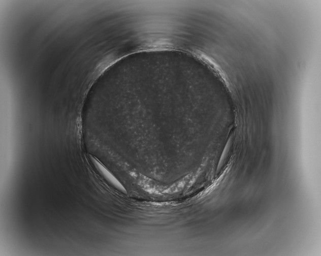 X0000095931457200802011011