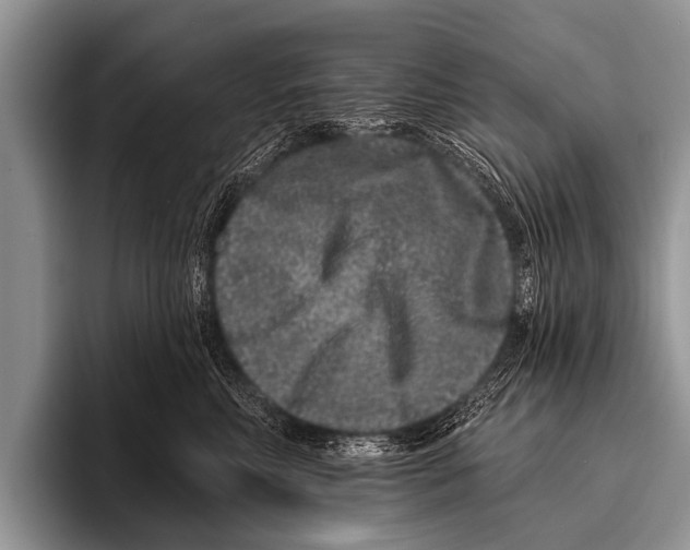 X0000095930618200802081218