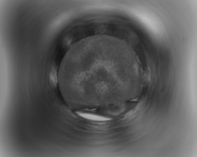 X0000095940479200801251113