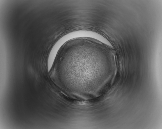 X0000095940618200801251111