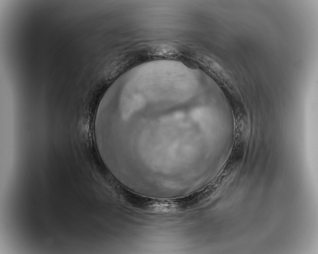 X0000095940415200802011045