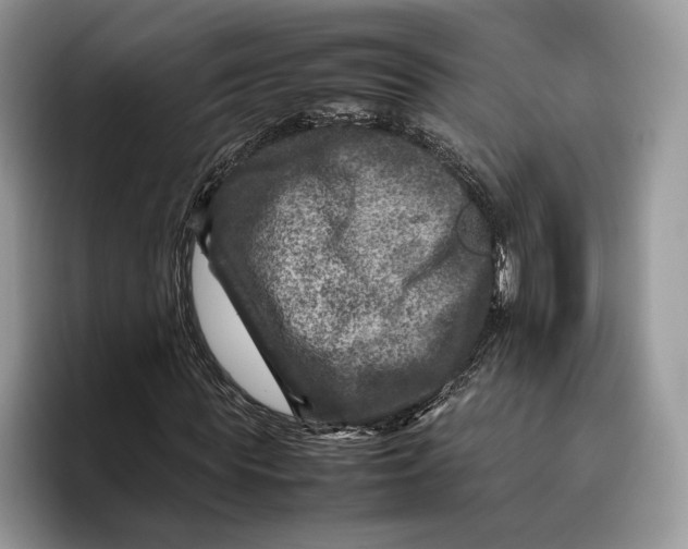 X0000095940819200802011039