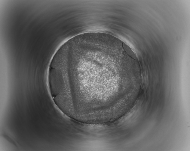 X0000095941103200802011036