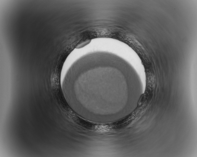 X0000095940419200802081241