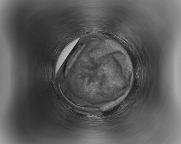 X0000095940516200802081240