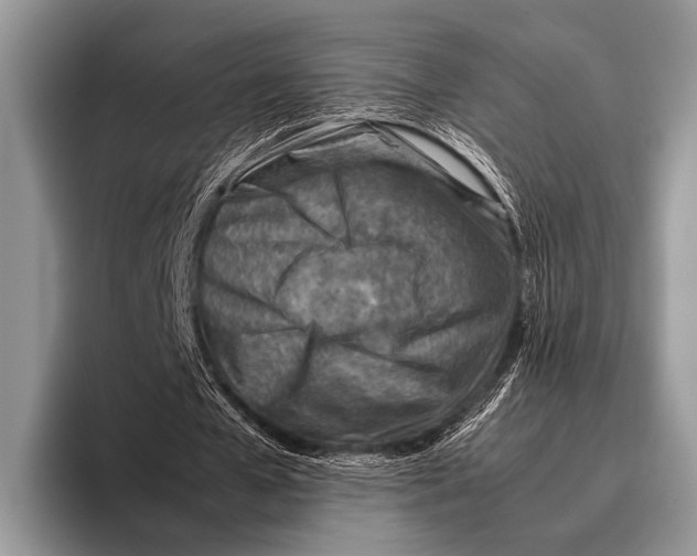 X0000095940577200802081239