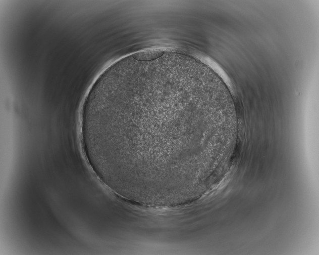 X0000095951099200802011056