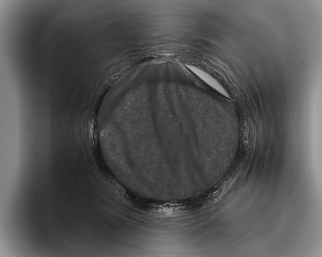 X0000095950420200802081301