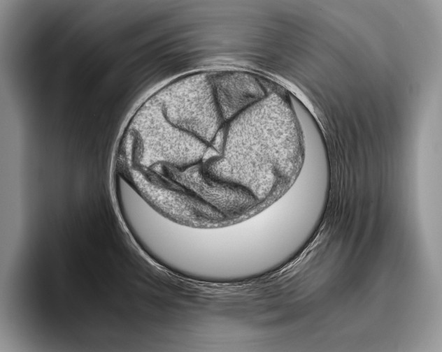 X0000095951387200802081248