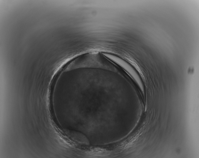 X0000095960387200801181450