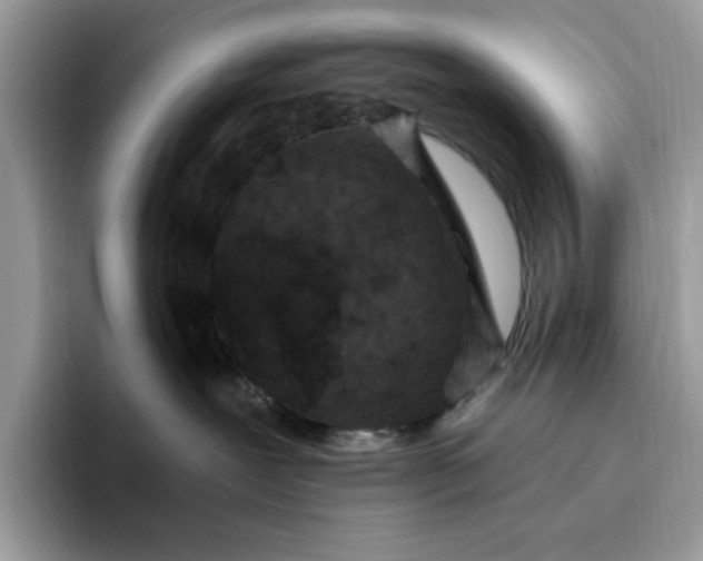 X0000095960239200801251156