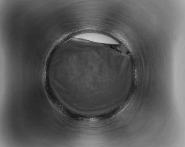 X0000095960492200802011125