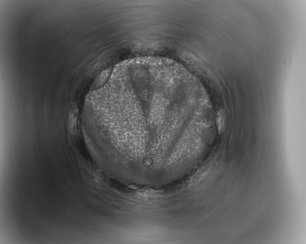 X0000095961059200802011117