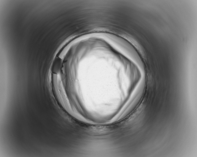 X0000095961198200802011115