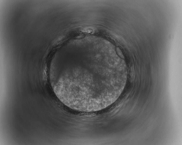 X0000095961394200802011112