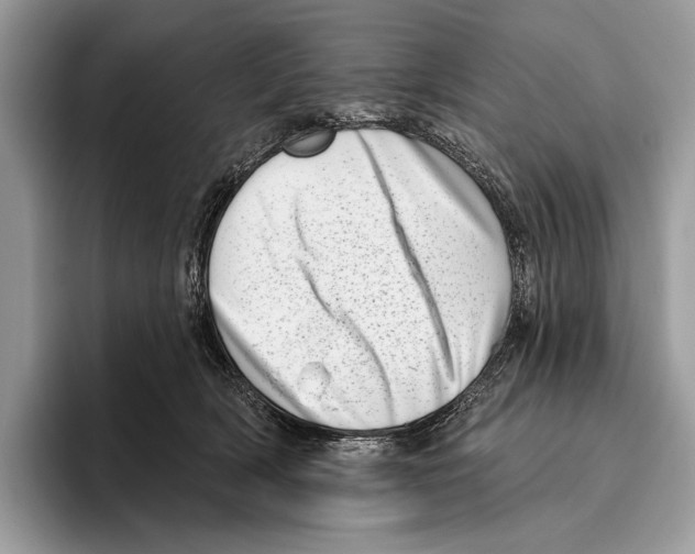 X0000095960418200802081321
