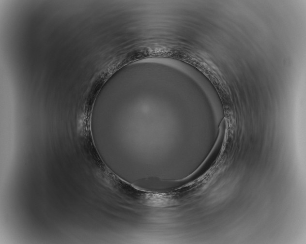 X0000095960419200802081321