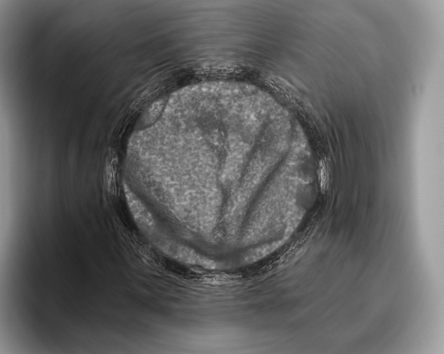 X0000095961059200802081313