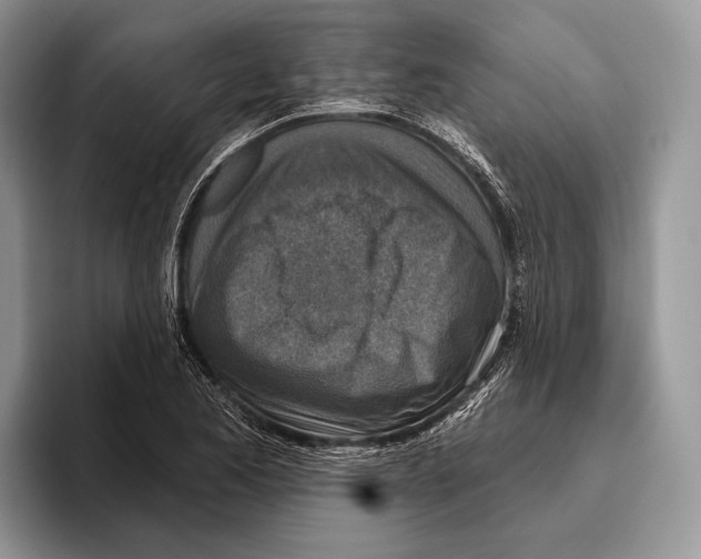 X0000095961173200802081311