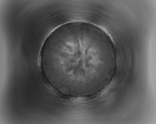 X0000096130879200801181110