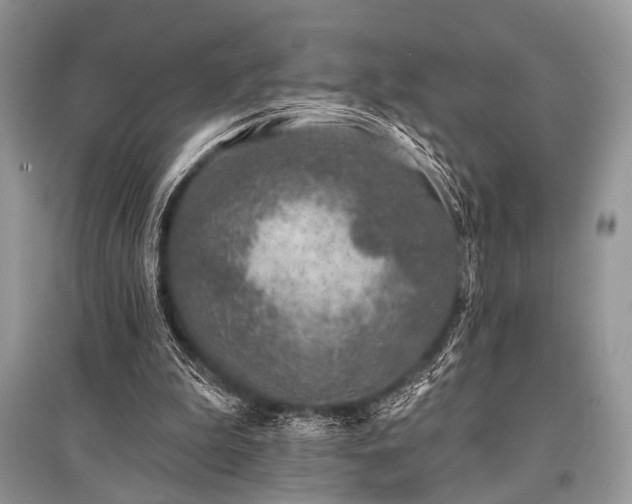 X0000096130199200801251025
