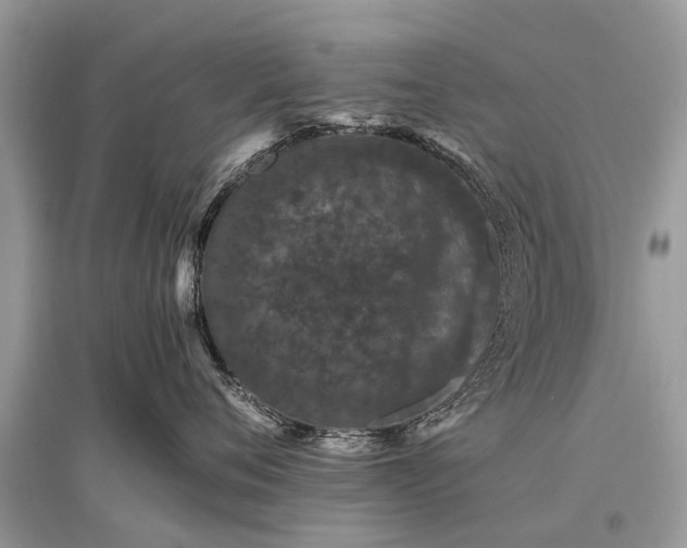 X0000096130720200801251017