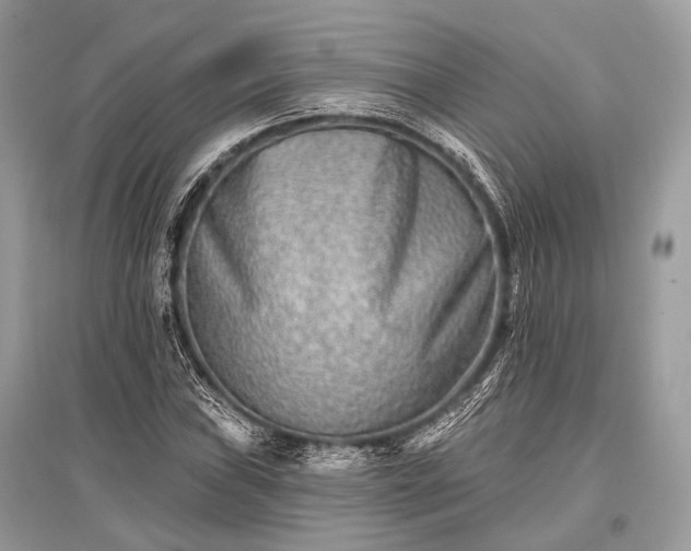 X0000096131019200801251011