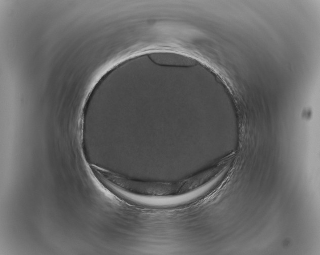 X0000096131519200801251004