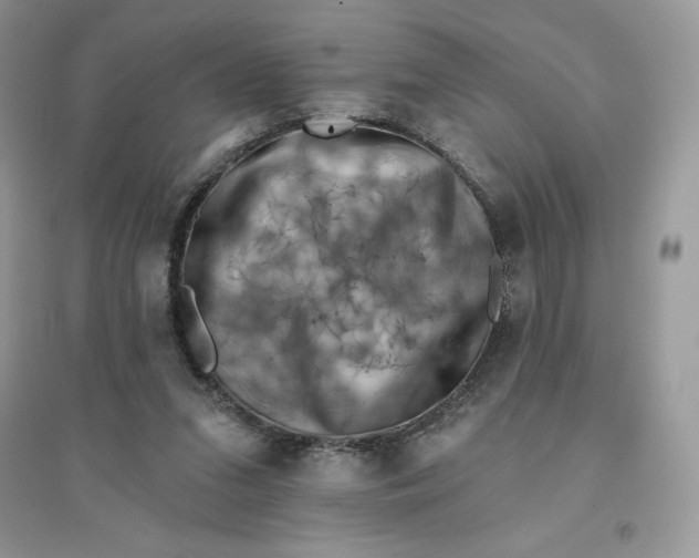 X0000096130207200802011155