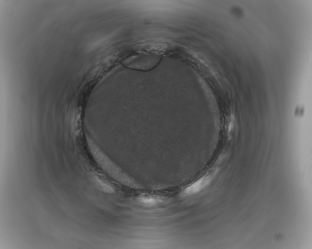 X0000096130818200802011146
