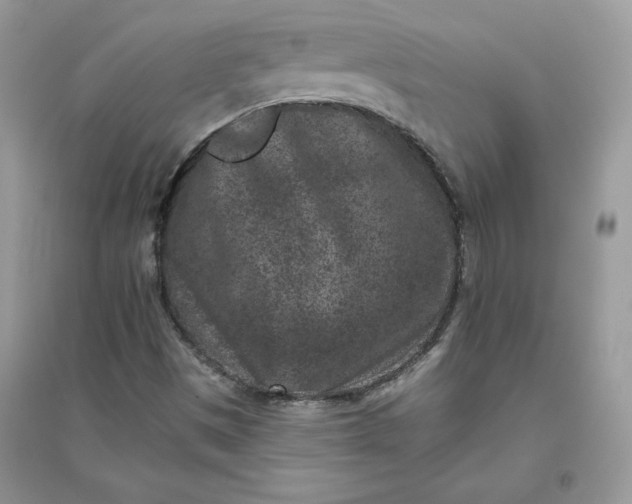 X0000096131497200802011135