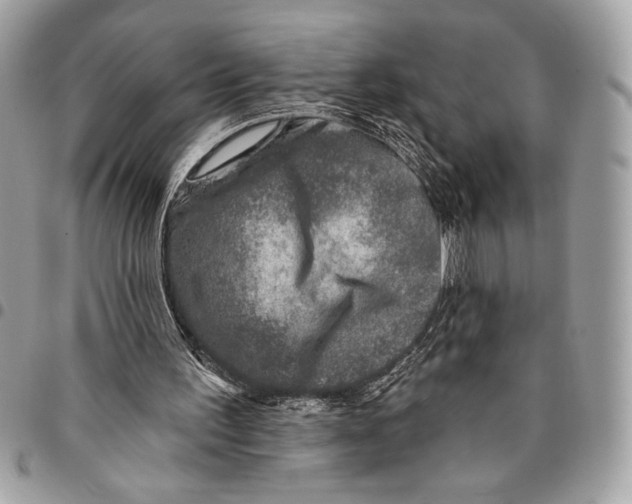 X0000096130195200802081333