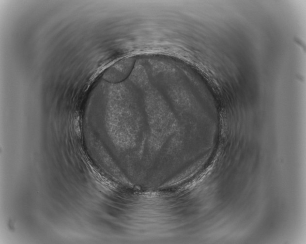 X0000096131497200802081313