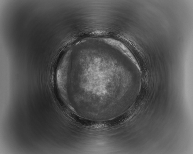 X0000096130696200802151314