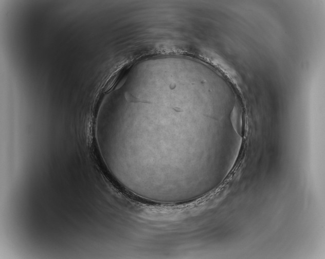 X0000096140009200801181142