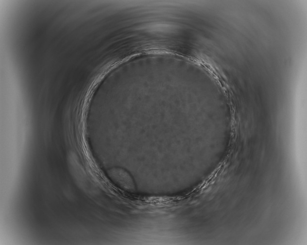 X0000096140145200801181139