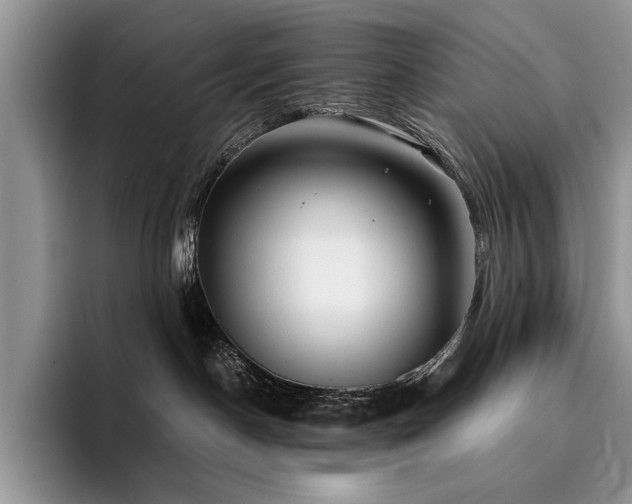 X0000096140190200801181140