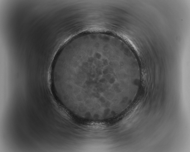 X0000096140487200801181136