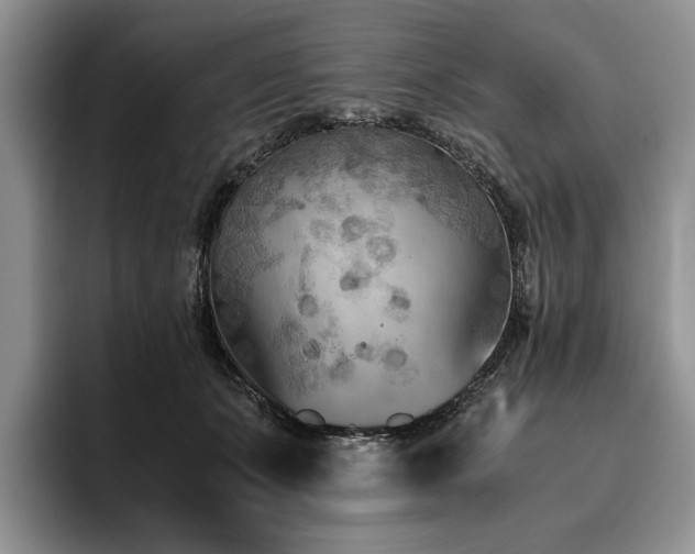 X0000096140511200801181135