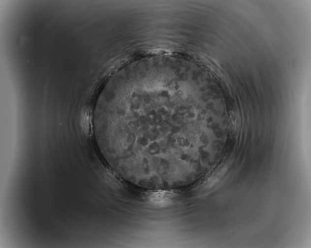 X0000096140527200801181135