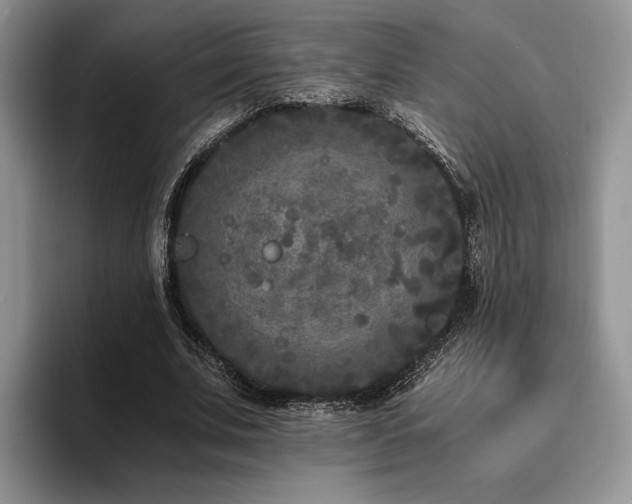 X0000096140679200801181133